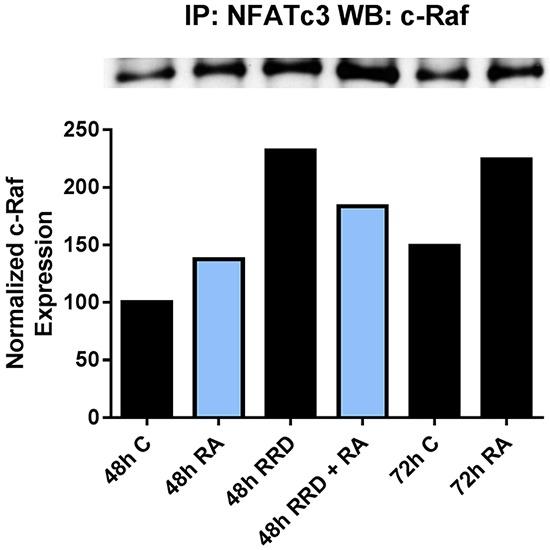 https://cdn.ncbi.nlm.nih.gov/pmc/blobs/871c/5216806/96d38fd6921d/oncotarget-07-46401-g005.jpg