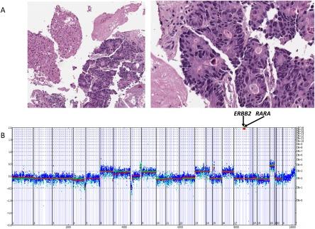 https://cdn.ncbi.nlm.nih.gov/pmc/blobs/871d/5900732/e32a1bc313ef/CNCR-124-1358-g005.jpg