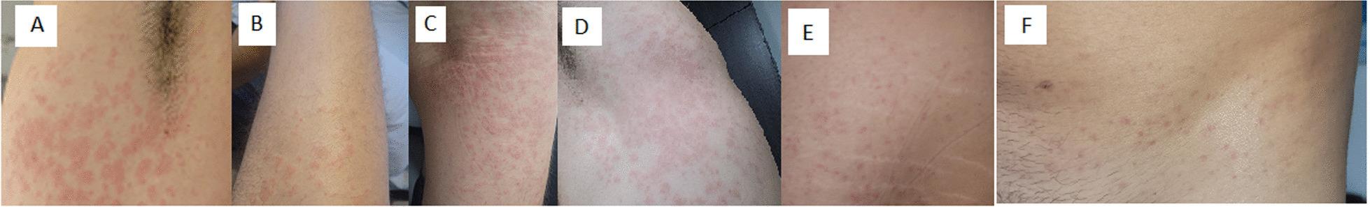 https://cdn.ncbi.nlm.nih.gov/pmc/blobs/8722/10157960/4fdaa5ec6f09/13256_2023_3904_Fig1_HTML.jpg