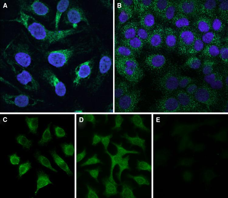 https://cdn.ncbi.nlm.nih.gov/pmc/blobs/8722/11028500/6b76eb3163c1/262_2010_943_Fig2_HTML.jpg
