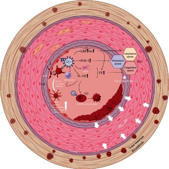 https://cdn.ncbi.nlm.nih.gov/pmc/blobs/8724/11300061/2e19470ff91d/CDTP2024-7288798.003.jpg
