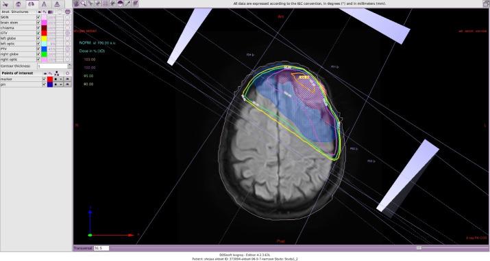 https://cdn.ncbi.nlm.nih.gov/pmc/blobs/8726/7785836/bd39e0d48aa1/roj-2020-00577f5.jpg