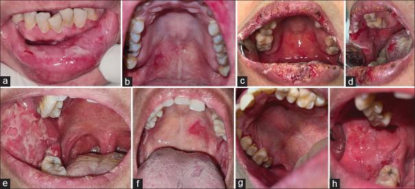 https://cdn.ncbi.nlm.nih.gov/pmc/blobs/872e/10683882/1dbc43bf42df/JOMFP-27-557-g001.jpg