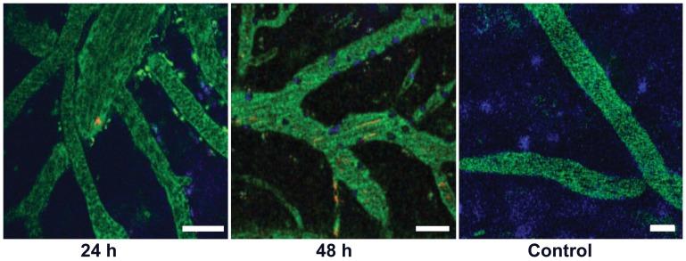 https://cdn.ncbi.nlm.nih.gov/pmc/blobs/8732/3432051/8462a4cd7a45/pone.0043913.g007.jpg
