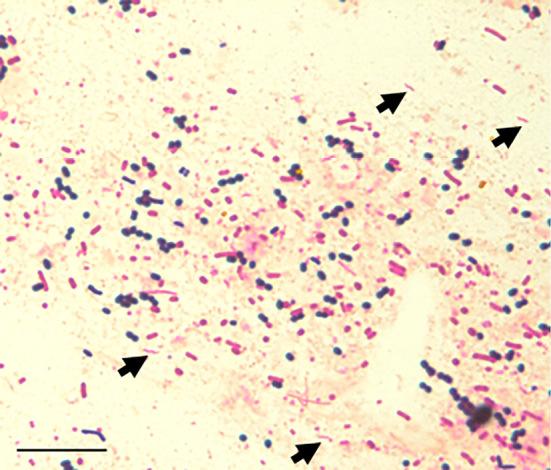 https://cdn.ncbi.nlm.nih.gov/pmc/blobs/8733/11604381/6b29bd9cca61/1349-7235-63-2939-g002.jpg