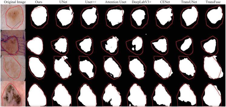 https://cdn.ncbi.nlm.nih.gov/pmc/blobs/8739/10994332/67308c4773f2/pone.0301019.g006.jpg
