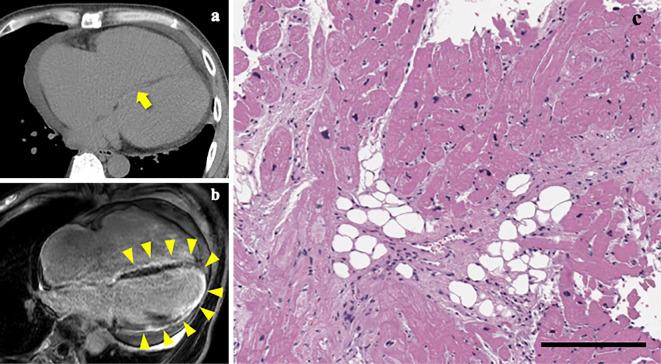 https://cdn.ncbi.nlm.nih.gov/pmc/blobs/8746/8079904/d137496af44c/1349-7235-60-1119-g007.jpg