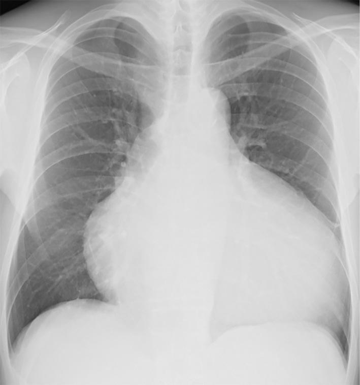 https://cdn.ncbi.nlm.nih.gov/pmc/blobs/8746/8079904/d7dc220a4b2c/1349-7235-60-1119-g004.jpg
