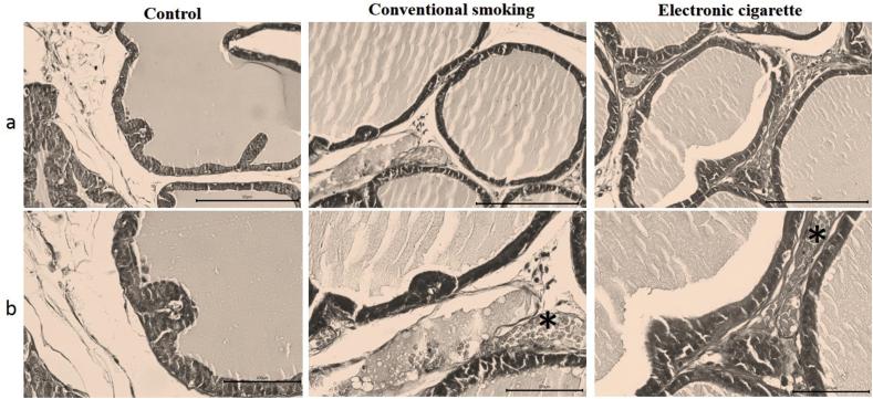 https://cdn.ncbi.nlm.nih.gov/pmc/blobs/8748/10318331/380619b58b29/gr5.jpg