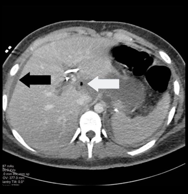 https://cdn.ncbi.nlm.nih.gov/pmc/blobs/874d/10479200/0a1595df0a2e/amjcaserep-24-e940984-g002.jpg