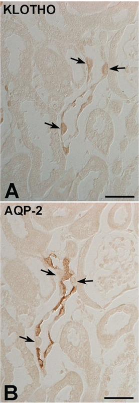 https://cdn.ncbi.nlm.nih.gov/pmc/blobs/874d/3980205/05e1dd5ed6a5/ejh-2014-1-2256-g003.jpg
