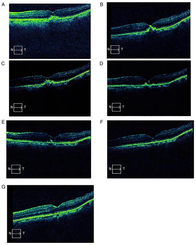 https://cdn.ncbi.nlm.nih.gov/pmc/blobs/8752/10203910/8402fc4cb9e0/etm-25-06-12000-g02.jpg