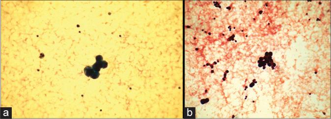 https://cdn.ncbi.nlm.nih.gov/pmc/blobs/8752/9345103/02a10769e945/Cytojournal-19-44-g002.jpg