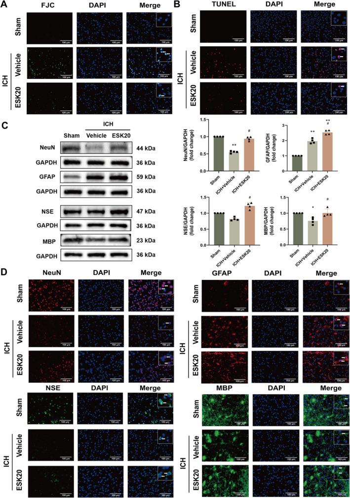 https://cdn.ncbi.nlm.nih.gov/pmc/blobs/8754/11652676/3db1bfed2113/CNS-30-e70145-g007.jpg