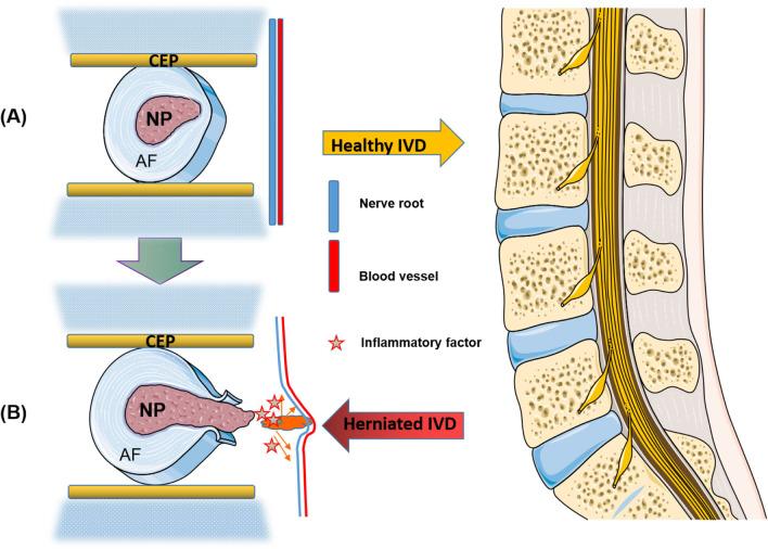 https://cdn.ncbi.nlm.nih.gov/pmc/blobs/8755/10273736/d718095e4d27/13018_2023_3869_Fig1_HTML.jpg