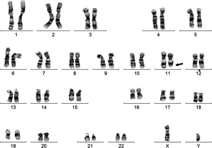 https://cdn.ncbi.nlm.nih.gov/pmc/blobs/8755/6028426/5053237fe022/CCR3-6-1268-g004.jpg