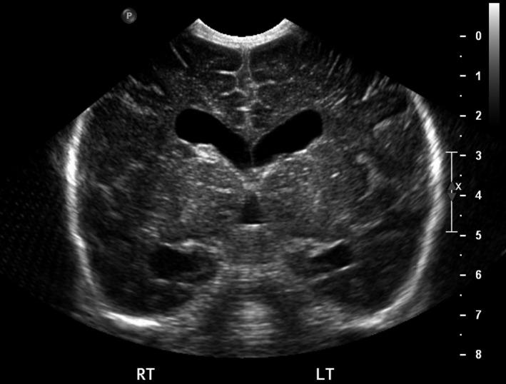 https://cdn.ncbi.nlm.nih.gov/pmc/blobs/8755/6028426/99c279304165/CCR3-6-1268-g002.jpg