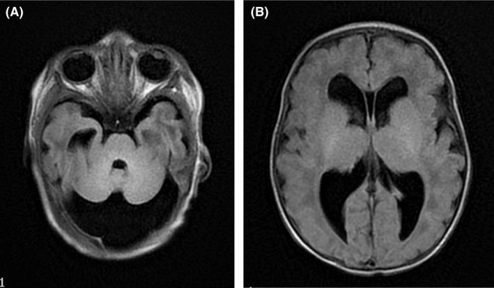 https://cdn.ncbi.nlm.nih.gov/pmc/blobs/8755/6028426/e8c5e184a95c/CCR3-6-1268-g003.jpg