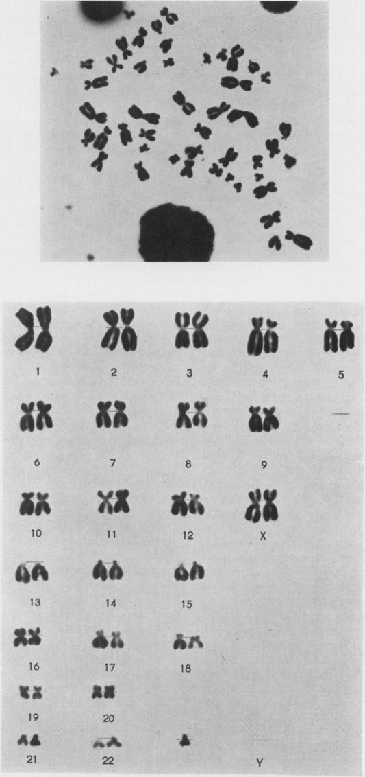 https://cdn.ncbi.nlm.nih.gov/pmc/blobs/875f/1468550/0297d36b3e01/jmedgene00381-0058-a.jpg