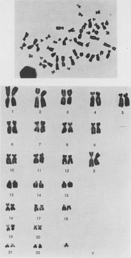 https://cdn.ncbi.nlm.nih.gov/pmc/blobs/875f/1468550/06aeec450250/jmedgene00381-0057-a.jpg