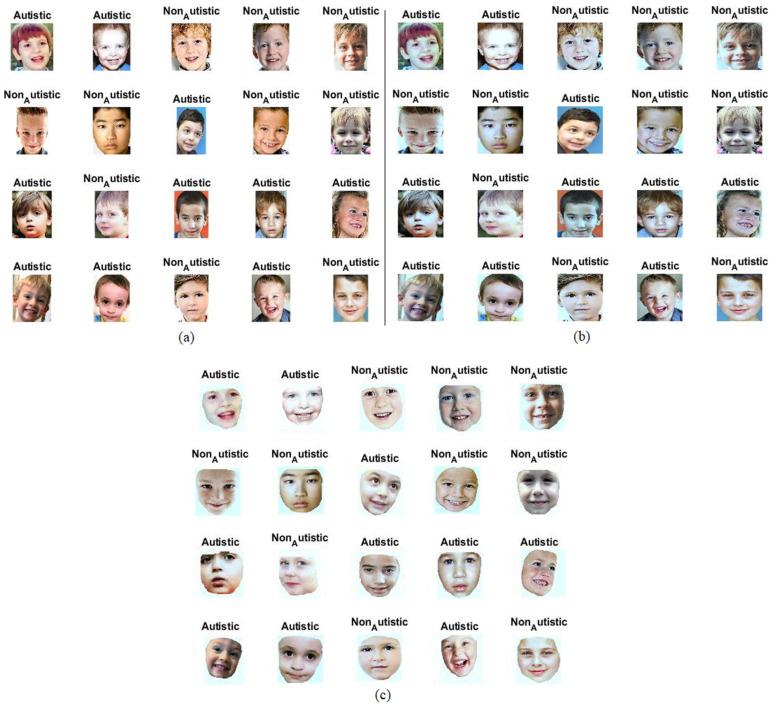 https://cdn.ncbi.nlm.nih.gov/pmc/blobs/8761/10527645/d720ed9eb3d8/diagnostics-13-02948-g001.jpg