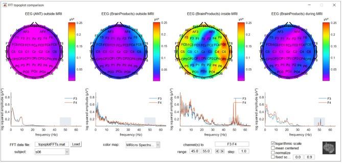 https://cdn.ncbi.nlm.nih.gov/pmc/blobs/8761/6335318/3ad6c5e7fcbe/fnins-12-01009-g0001.jpg