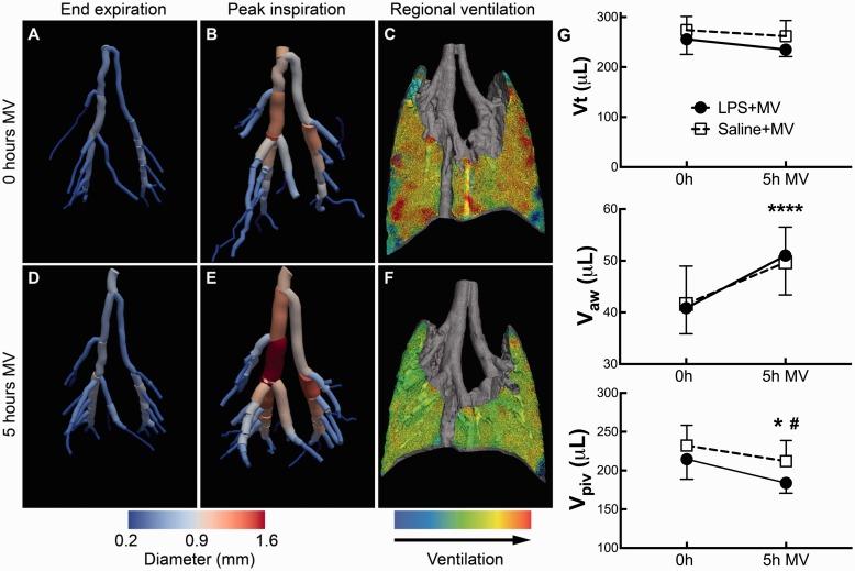 https://cdn.ncbi.nlm.nih.gov/pmc/blobs/8764/5888832/141a19a0d85b/10.1177_2045894018762242-fig5.jpg