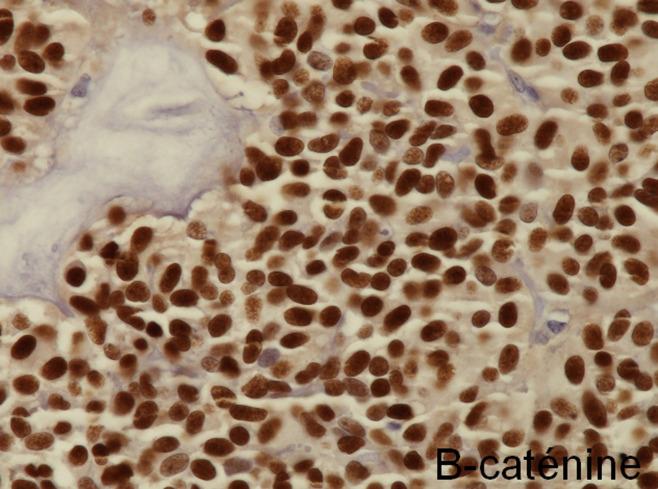 https://cdn.ncbi.nlm.nih.gov/pmc/blobs/8765/8627137/6a7f22307f80/PAMJ-40-110-g004.jpg