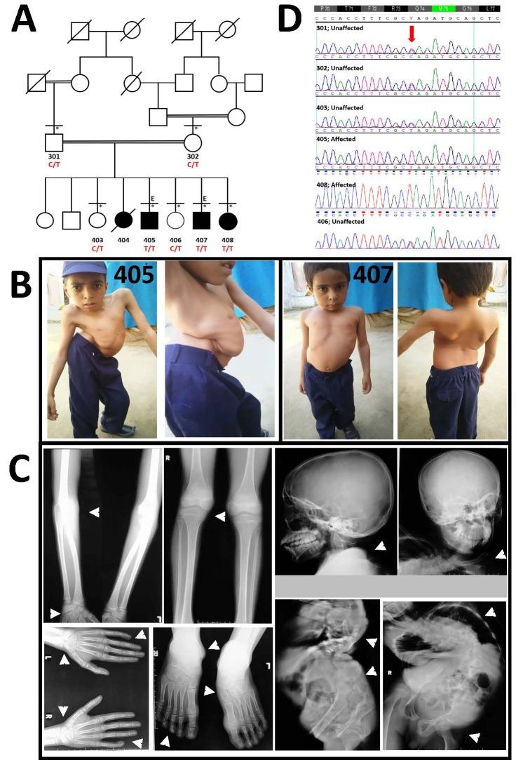 https://cdn.ncbi.nlm.nih.gov/pmc/blobs/8769/10524816/3d193b061ddf/yjbm_96_3_383_g01.jpg