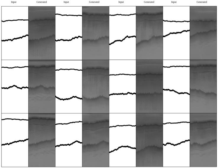 https://cdn.ncbi.nlm.nih.gov/pmc/blobs/876d/6960960/dc5d0ade0c55/sensors-19-05479-g008.jpg