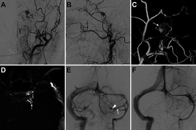 https://cdn.ncbi.nlm.nih.gov/pmc/blobs/8770/10550532/607ca74b59b3/CASE23143f1.jpg