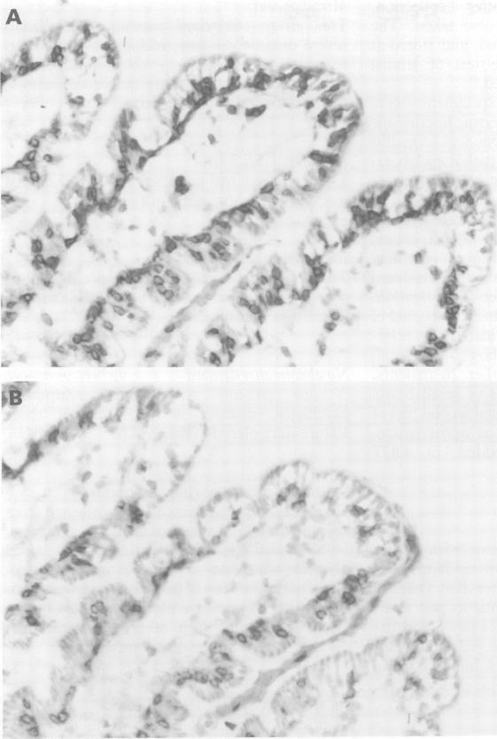 https://cdn.ncbi.nlm.nih.gov/pmc/blobs/8774/1374795/5a6d5b96b415/gut00538-0056-a.jpg