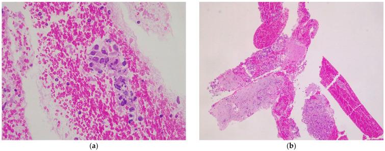 https://cdn.ncbi.nlm.nih.gov/pmc/blobs/8774/9497513/e79117149054/diagnostics-12-02214-g003.jpg