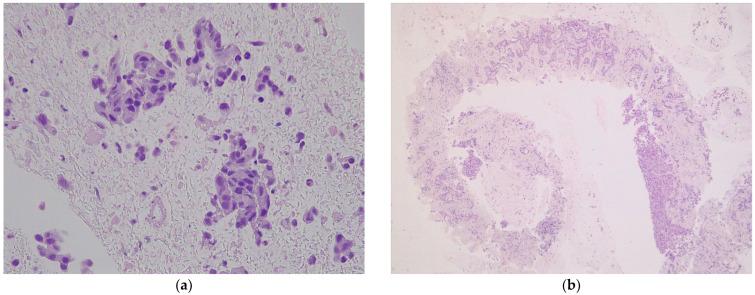 https://cdn.ncbi.nlm.nih.gov/pmc/blobs/8774/9497513/e9c0ca18dc2c/diagnostics-12-02214-g002.jpg