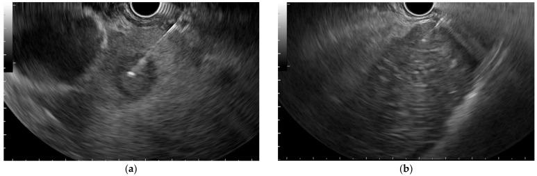 https://cdn.ncbi.nlm.nih.gov/pmc/blobs/8774/9497513/ee4fc6e79257/diagnostics-12-02214-g001.jpg