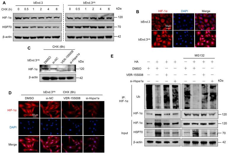 https://cdn.ncbi.nlm.nih.gov/pmc/blobs/8775/11667810/dc3fb210db9d/ijbsv21p0175g004.jpg