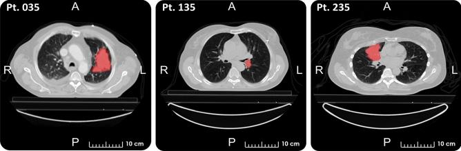 https://cdn.ncbi.nlm.nih.gov/pmc/blobs/8777/9391464/693dee83602f/41598_2022_18085_Fig1_HTML.jpg
