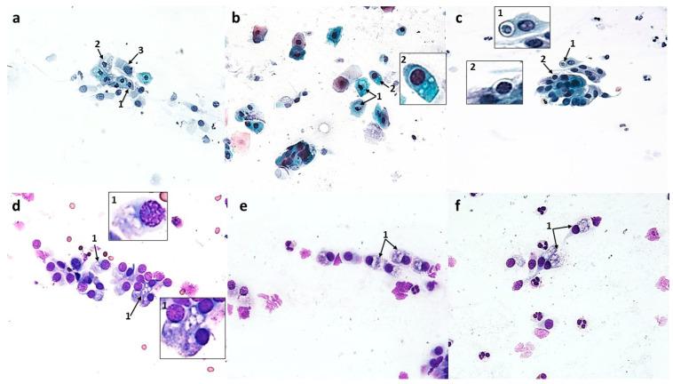 https://cdn.ncbi.nlm.nih.gov/pmc/blobs/8780/10706206/0ac4861f7107/cells-12-02697-g011.jpg