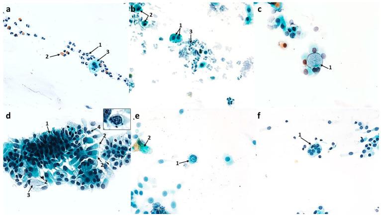 https://cdn.ncbi.nlm.nih.gov/pmc/blobs/8780/10706206/41c4e15e466f/cells-12-02697-g006.jpg