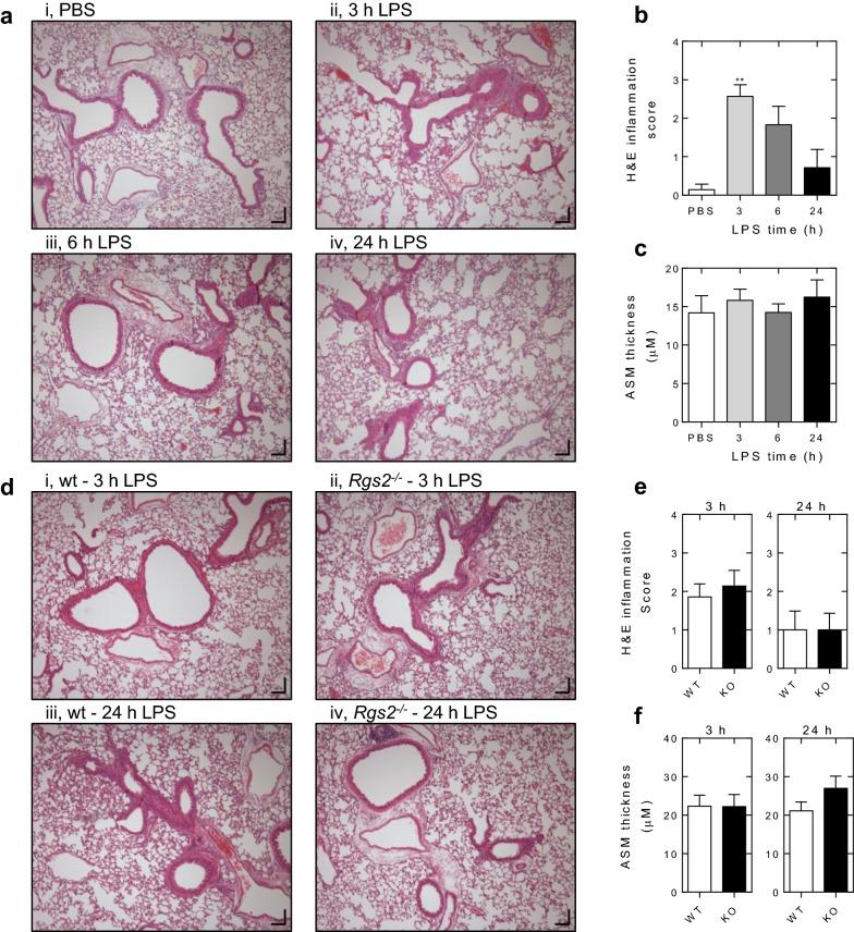 https://cdn.ncbi.nlm.nih.gov/pmc/blobs/8780/6166284/08ef15c3eaea/13223_2018_266_Fig3_HTML.jpg