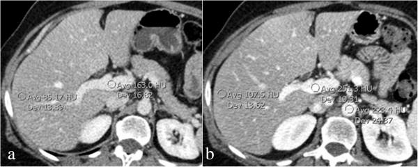 https://cdn.ncbi.nlm.nih.gov/pmc/blobs/8782/4301902/1b74fcbfcbe5/13256_2014_3024_Fig4_HTML.jpg