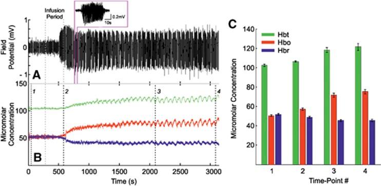 https://cdn.ncbi.nlm.nih.gov/pmc/blobs/8786/3790930/1664221d72f0/jcbfm2013115f4.jpg