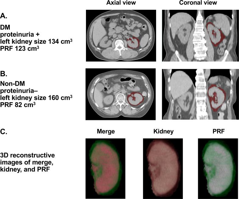 https://cdn.ncbi.nlm.nih.gov/pmc/blobs/8793/10936520/b65ff8f08ae4/bmjdrc-2023-003832f01.jpg