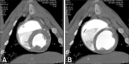https://cdn.ncbi.nlm.nih.gov/pmc/blobs/8795/2839088/a3954e0e435a/jvs-9-121-g001.jpg