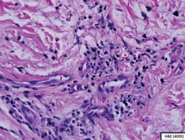 https://cdn.ncbi.nlm.nih.gov/pmc/blobs/8795/4371676/0815c531040e/abd-90-02-0245-g03.jpg
