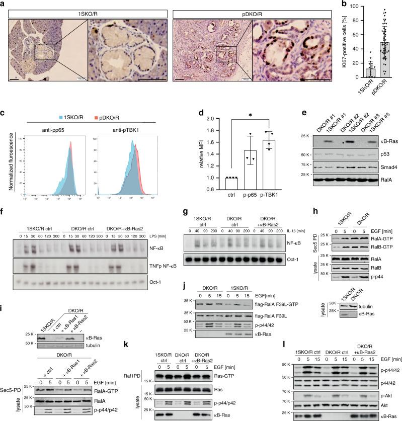 https://cdn.ncbi.nlm.nih.gov/pmc/blobs/8798/7343838/0c25bf66136a/41467_2020_17226_Fig4_HTML.jpg