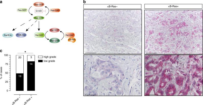 https://cdn.ncbi.nlm.nih.gov/pmc/blobs/8798/7343838/5d70ddcd1b37/41467_2020_17226_Fig1_HTML.jpg