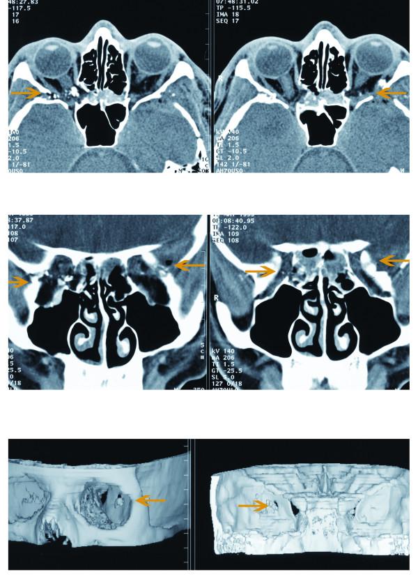 https://cdn.ncbi.nlm.nih.gov/pmc/blobs/8799/2847549/ecd879b8b798/1471-2415-10-6-1.jpg