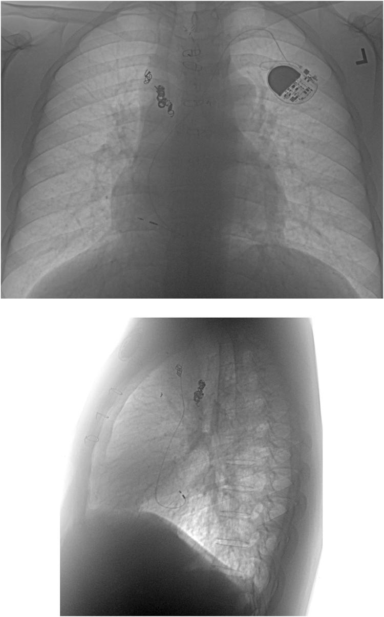 https://cdn.ncbi.nlm.nih.gov/pmc/blobs/87a6/5419993/6c7b14360bce/gr2.jpg