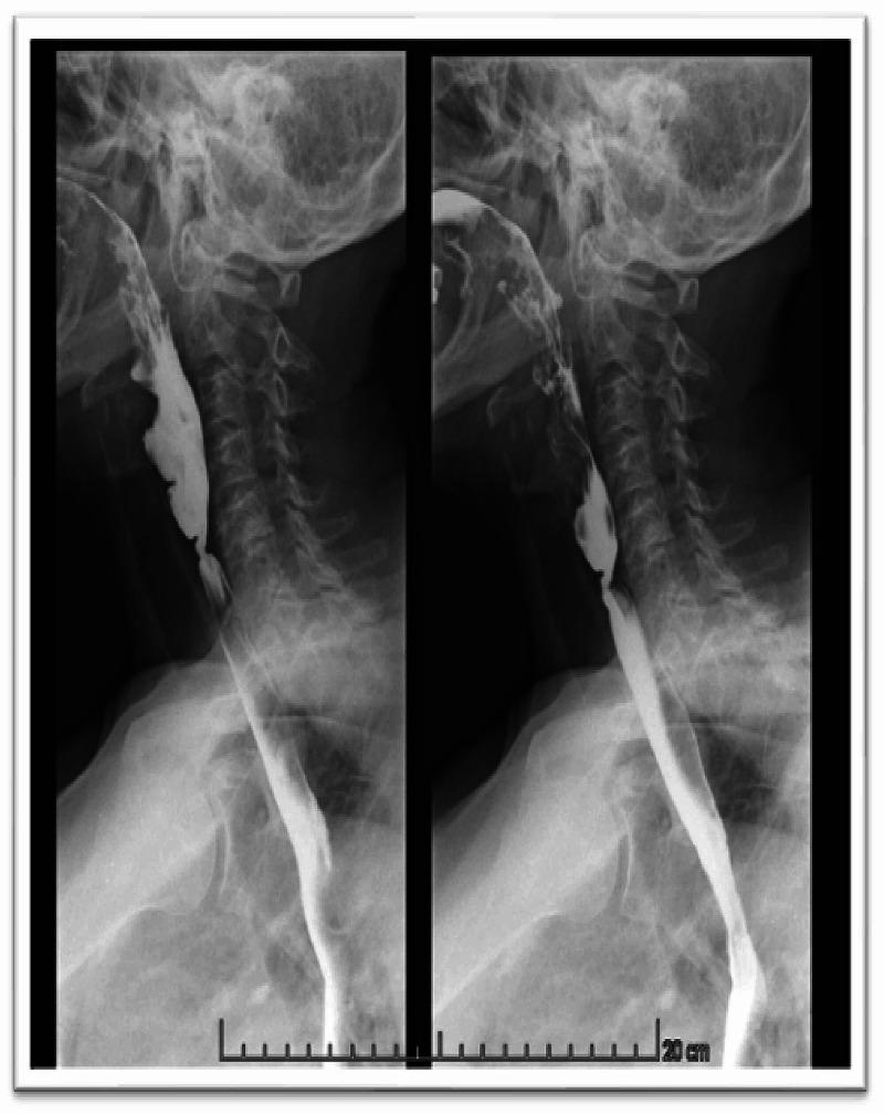 https://cdn.ncbi.nlm.nih.gov/pmc/blobs/87a6/7920230/4dd4a65aa2bc/cureus-0013-00000013010-i01.jpg